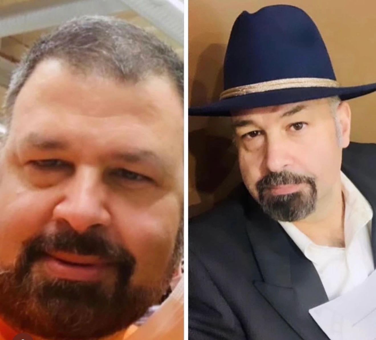 Weight loss success story 1 - All Health Medical Group patient transformation