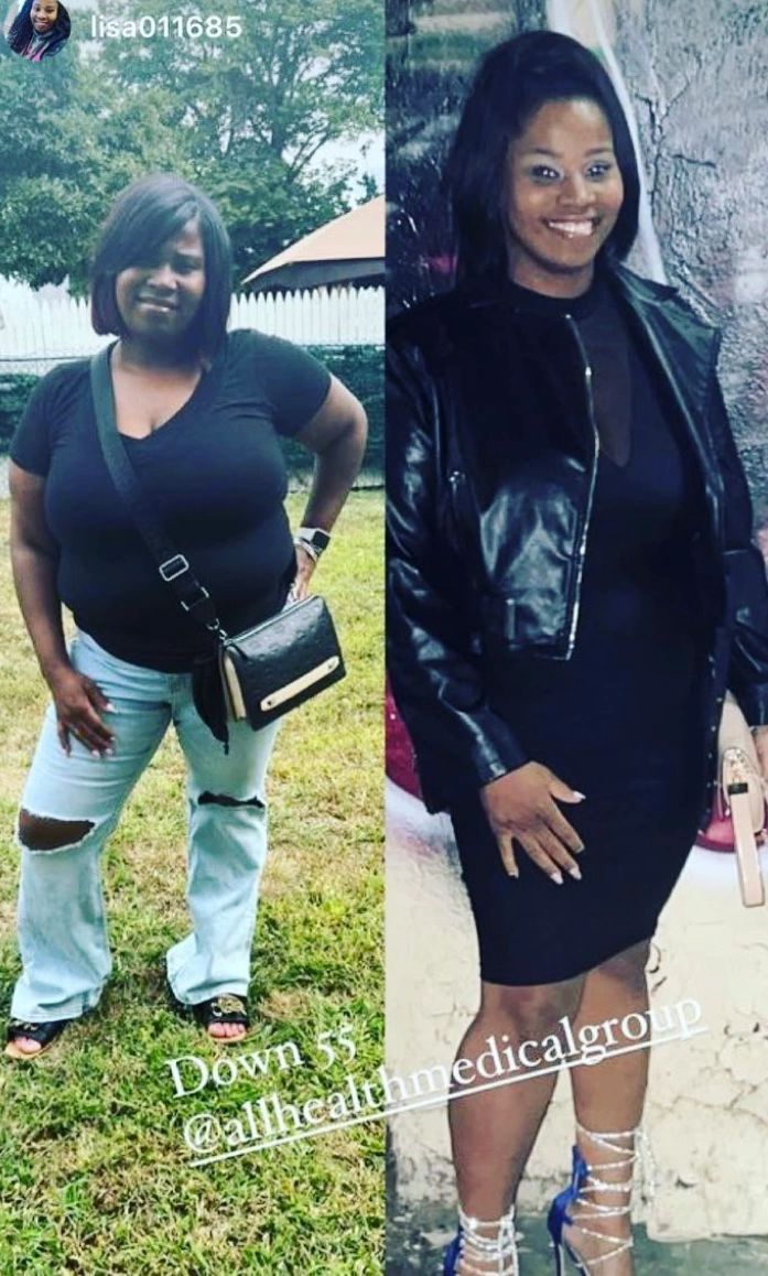 Weight loss success story 3 - All Health Medical Group patient transformation