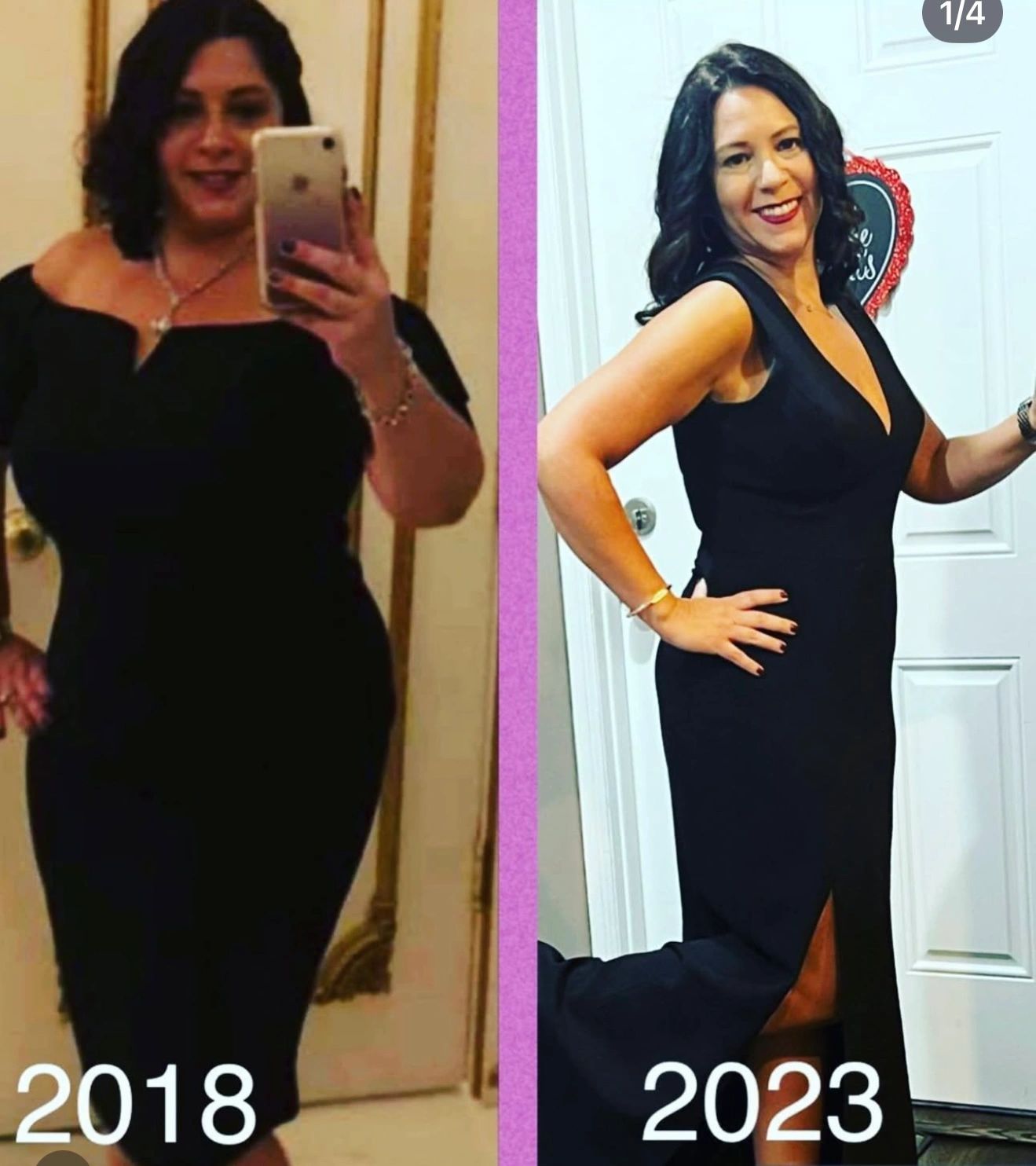 Weight loss success story 7 - All Health Medical Group patient transformation